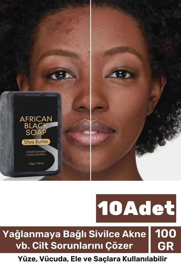 100% Doğal Güzel Kokulu El Yüz Saç Vücut Cilt Onaran Kolajen Etkili Afrika Bitkisel Sabun 10 Adet - Image 1