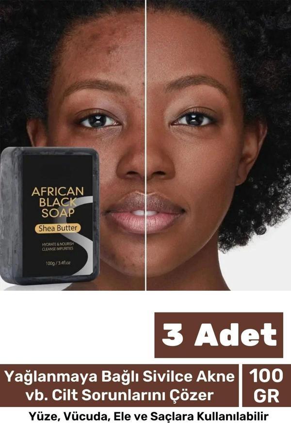 100% Doğal Güzel Kokulu El Yüz Saç Vücut Cilt Onaran Kolajen Etkili Afrika Bitkisel Sabun 3 Adet - Image 1