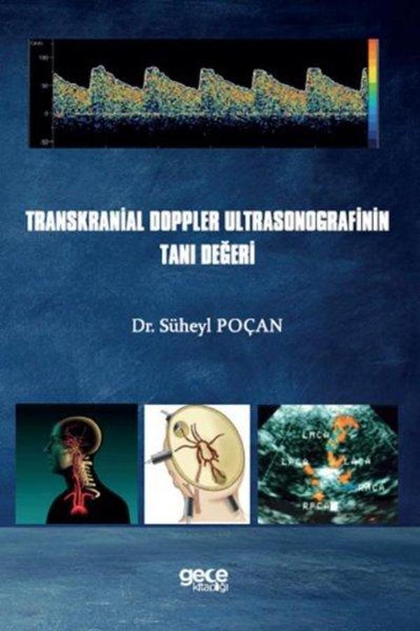 Transkranial Doppler Ultrasonografinin Tanı Değeri - Gece Kitaplığı - Image 1