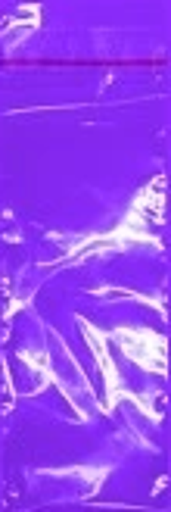 ŞEFFAF BANTLI POŞET (5X15) OPP 10000 - Image 1