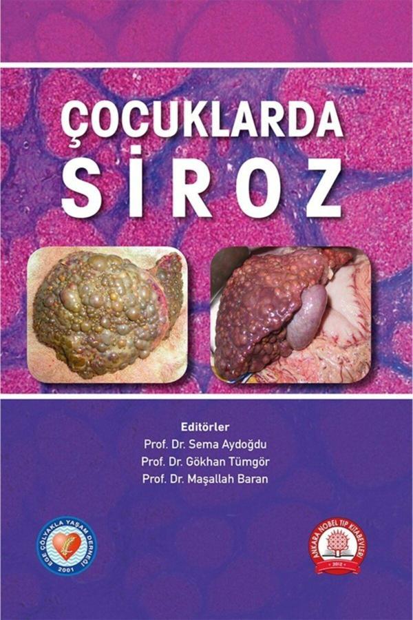 Çocuklarda Siroz - Ankara Nobel Tıp - Image 1