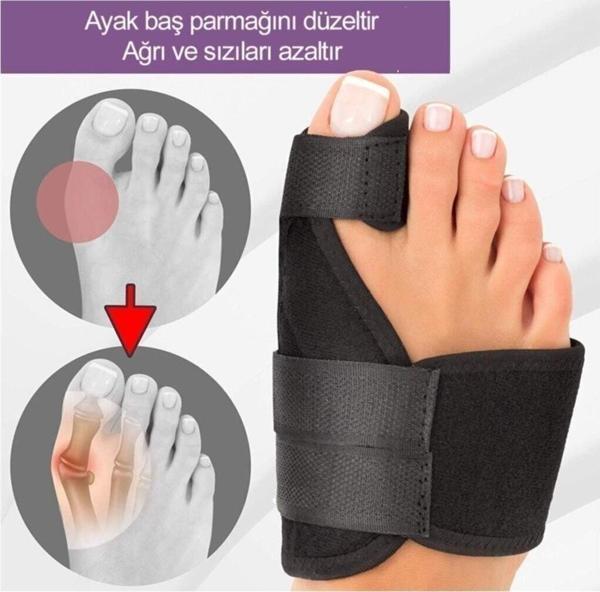 Onefix Fuar Sol Halluks Valgus Gece Ateli - Image 1
