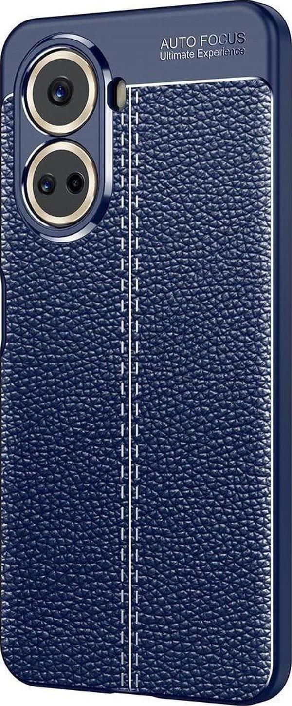 Anka Cep Telefonu Aksesuarları Huawei Nova 10 Se Kılıf Niss Deri Görünümlü Silikon Kapak + Ekran Koruma - Image 1