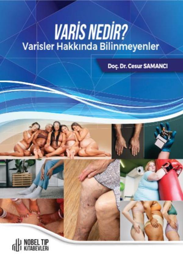 Varis Nedir ? Varisler Hakkında Bilinmeyenler - Nobel Tıp Kitabevleri - Image 1