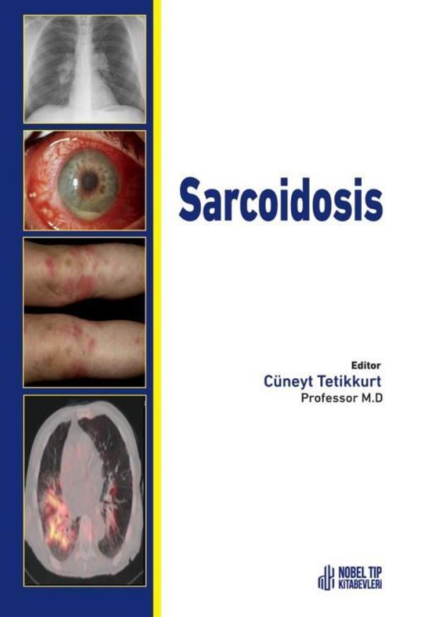 Sarcoidosis - Nobel Tıp Kitabevleri - Image 1