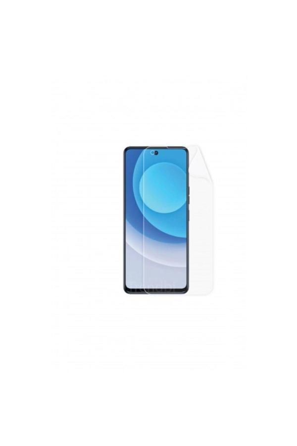 TECNO CAMON 19 EKRAN KORUYUCU POLİÜRETAN FİLM - Image 1