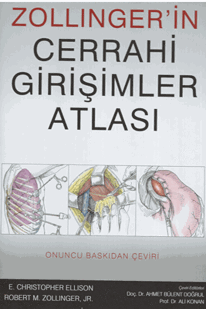 Palme Yayınevi Zollinger'İn Cerrahi Girişimler Atlası
