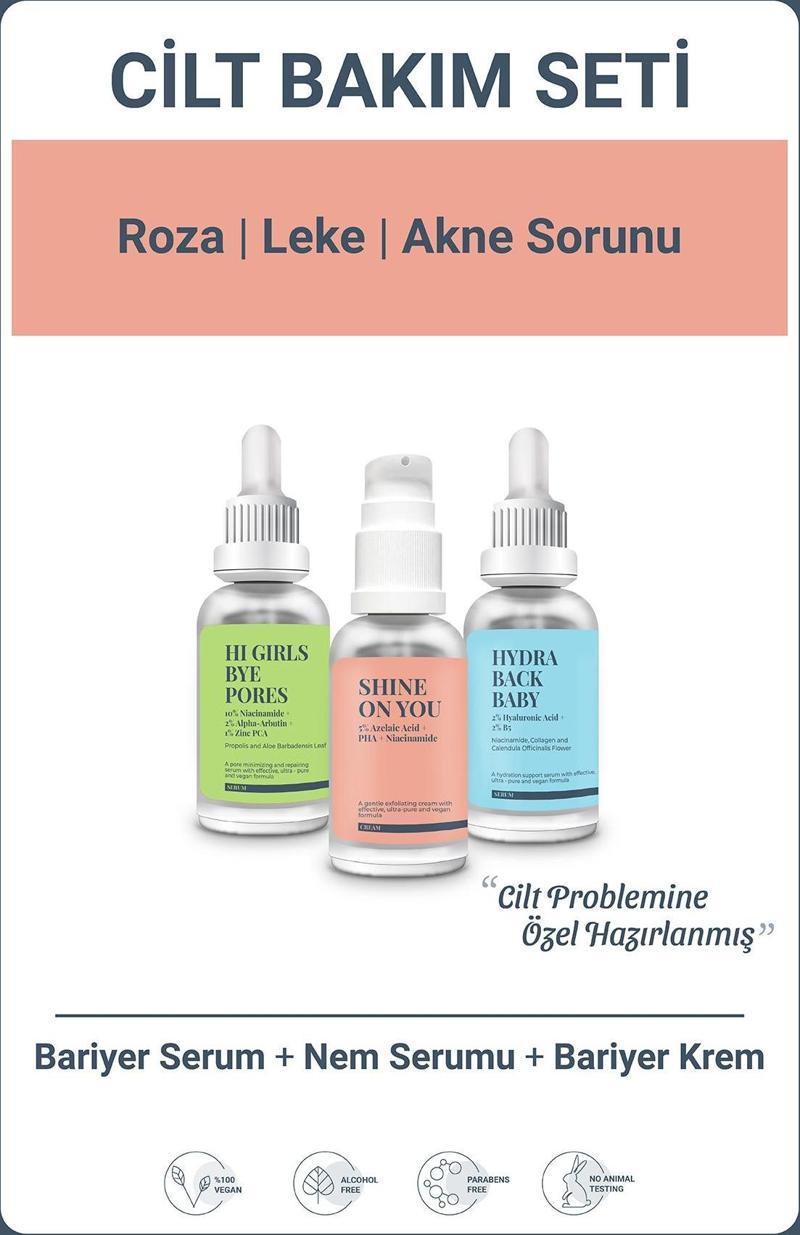 Roza Leke Akne Sorunu