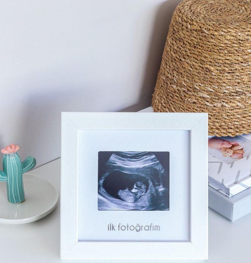 Ilk Fotoğrafım Bebek Ultrason Çerçevesi-Bebek Odası Resim Anı Çerçevesi