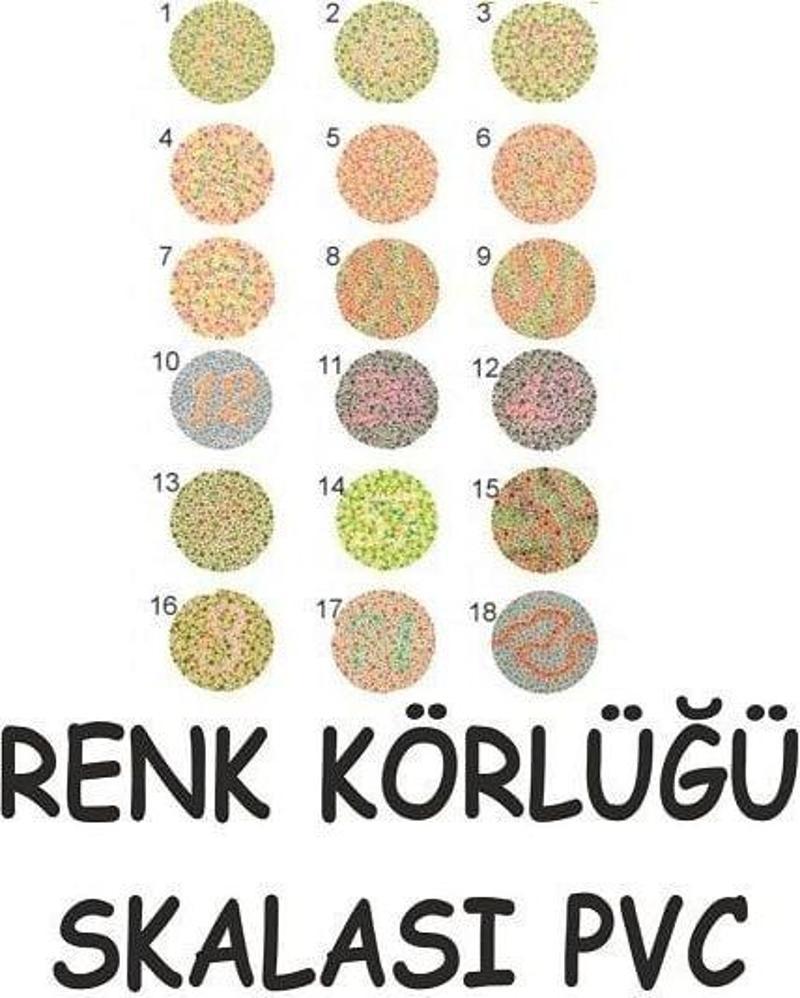 Renk Körlüğü Skalası