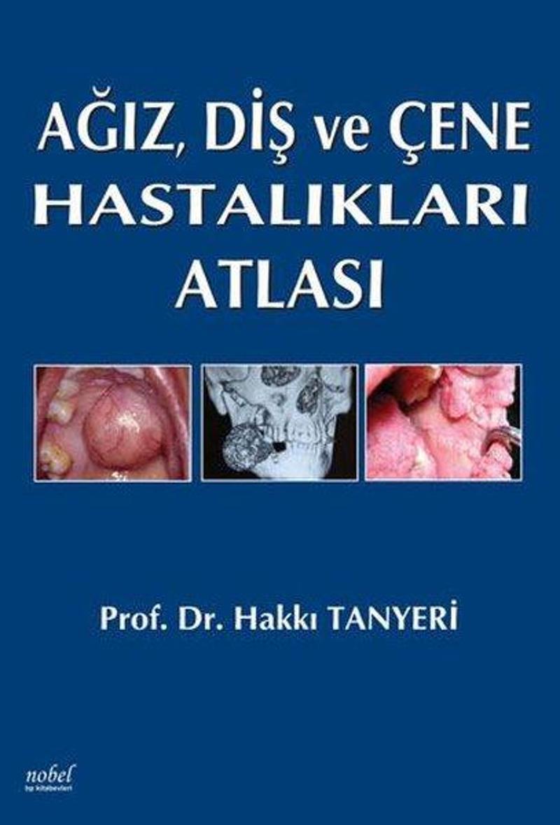 Ağız Diş ve Çene Hastalıkları Atlası